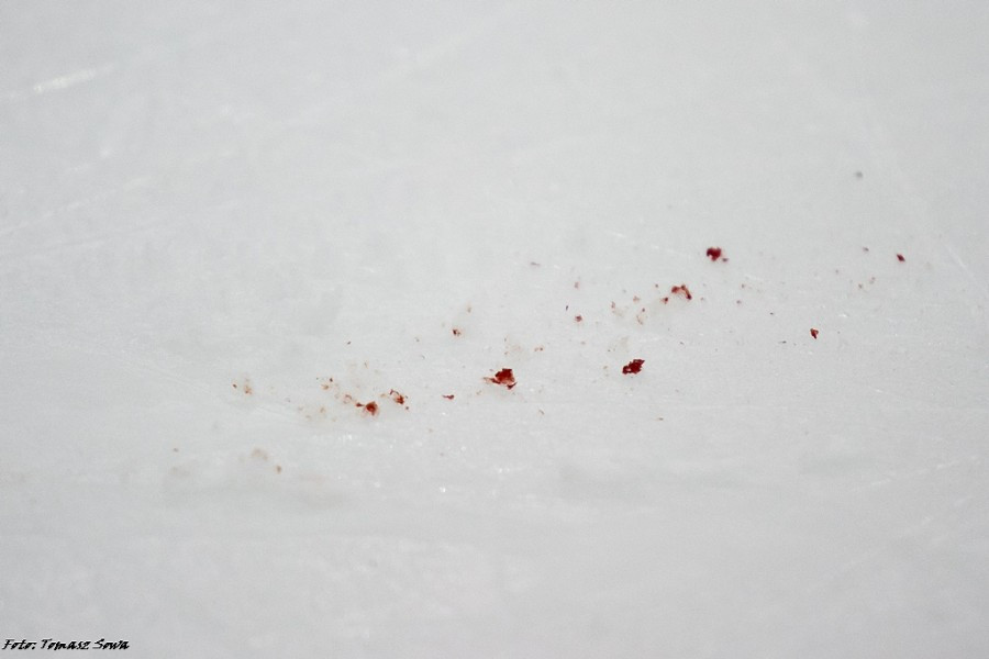 Mistrz lepszy od wicemistrza